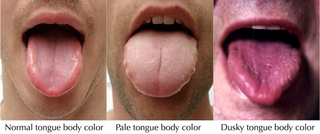 Ansøgning klodset maske Your Tongue Doesn't Lie | Family Tree Acupuncture