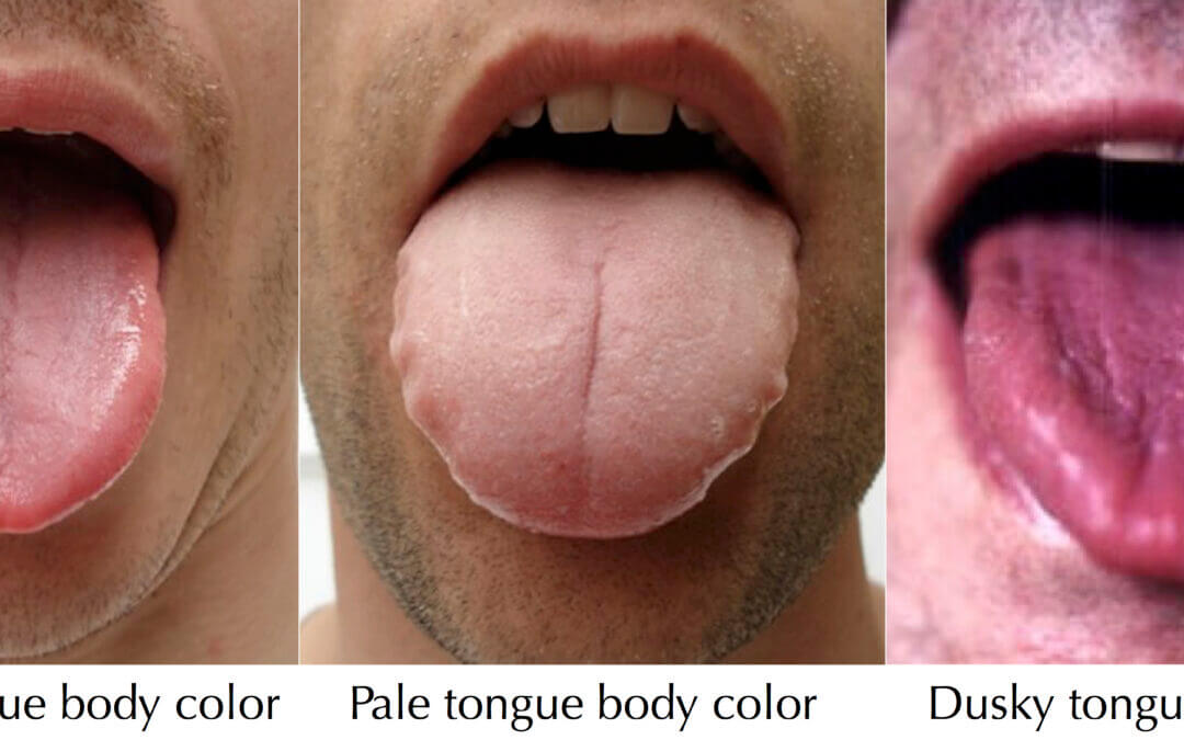 Your Tongue Doesn’t Lie